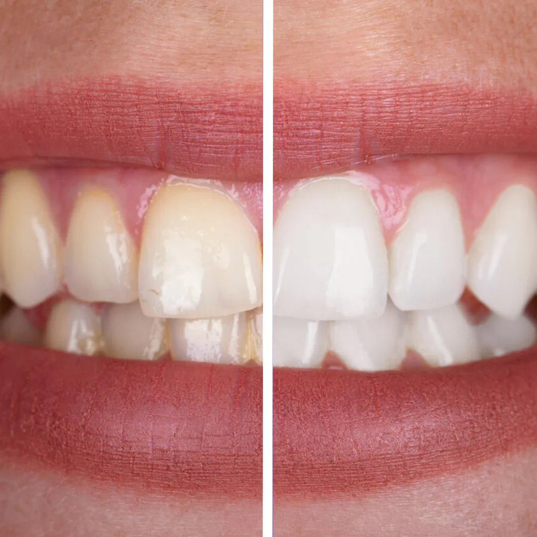 OliVera - V34 Purple Toothpaste